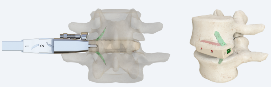 微信圖片_20241114130741 微信圖片_20241114130741