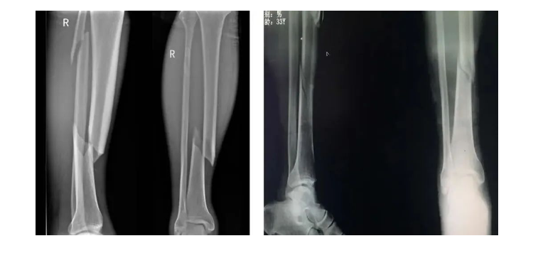 微信圖片_20240306125320 微信圖片_20240306125320